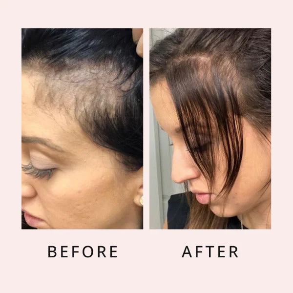 HairGrowthSerum 11 600x