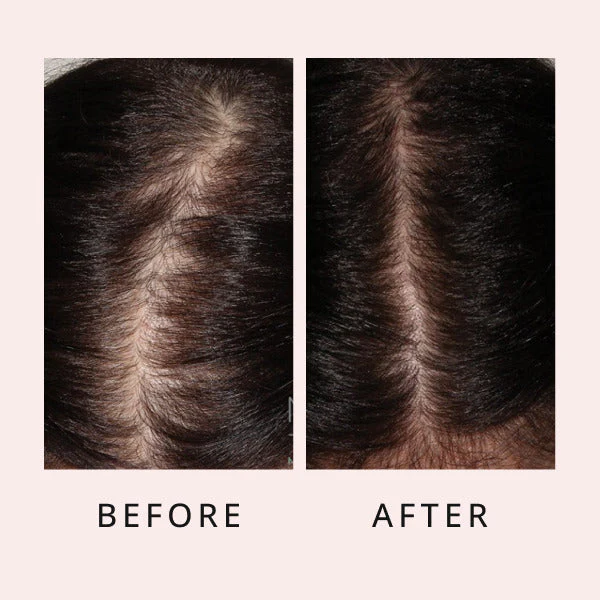 HairGrowthSerum 12 600x