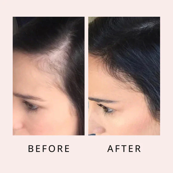 HairGrowthSerum 13 600x