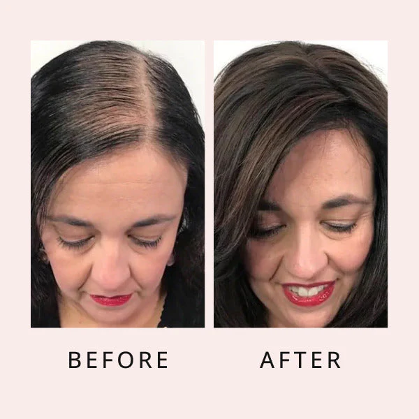 HairGrowthSerum 18 600x