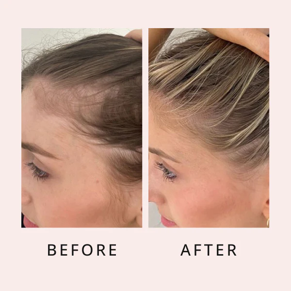 Hair Growth Serum 14 600x