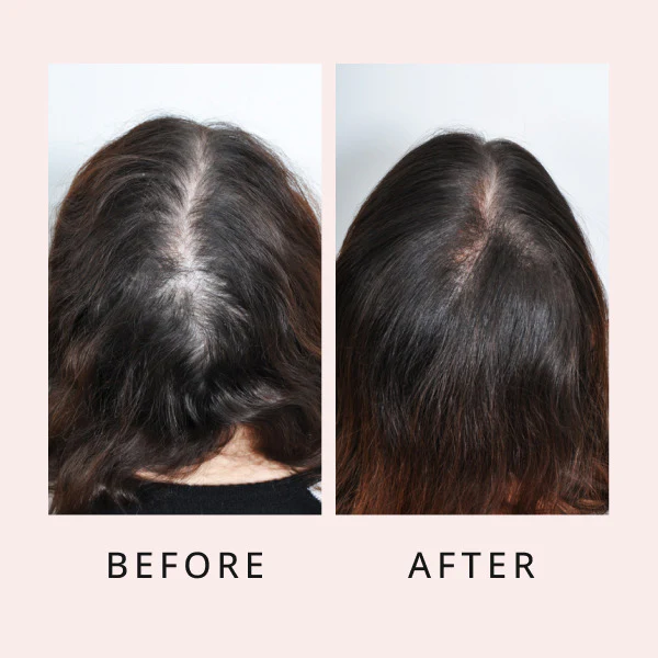 Hair Growth Serum 16 600x